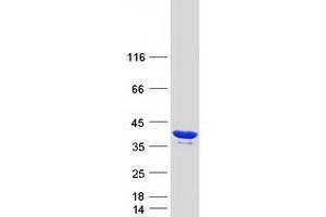Validation with Western Blot