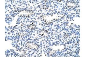 PAIP1 antibody was used for immunohistochemistry at a concentration of 4-8 ug/ml to stain Alveolar cells (arrows) in Human Lung.