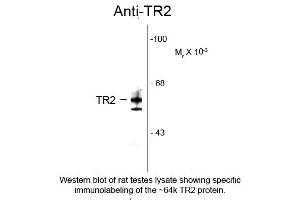 Western blot of Anti-Testicular Receptor 2 (TR2) (Rabbit) Antibody - 100-401-E45 Western Blot of Rabbit Anti-Testicular Receptor 2 (TR2) Antibody. (NR2C1 抗体  (N-Term))