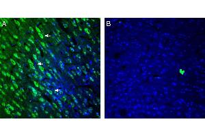 Expression of 5HT2A Receptor in rat cingulate cortex. (5-Hydroxytryptamine (serotonin) Receptor 2A (HTR2A) Peptide)