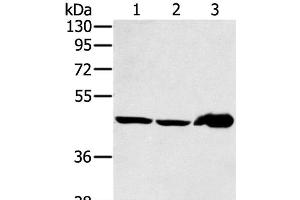 Western Blot analysis of Mouse liver tissue and PC3 cell, Human fetal liver tissue using SEC14L2 Polyclonal Antibody at dilution of 1:400 (SEC14L2 抗体)