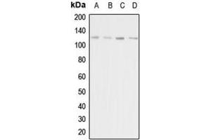 Western blot analysis of Adenylate Cyclase 1 expression in HeLa (A), HEK293T (B), mouse liver (C), rat kidney (D) whole cell lysates.