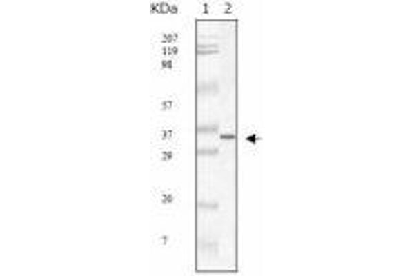 SARS-Coronavirus Membrane Protein (SARS-CoV M) 抗体