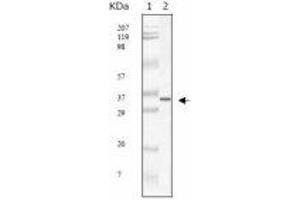 Image no. 1 for anti-SARS-Coronavirus Membrane Protein (SARS-CoV M) antibody (ABIN1502334) (SARS-Coronavirus Membrane Protein (SARS-CoV M) 抗体)