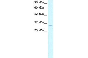 WB Suggested Anti-CDK4 Antibody Titration: 1. (CDK4 抗体  (C-Term))