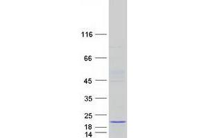 Validation with Western Blot (PRR15L Protein (Myc-DYKDDDDK Tag))