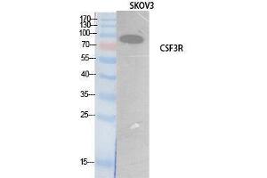 Western Blotting (WB) image for anti-Colony Stimulating Factor 3 Receptor (Granulocyte) (CSF3R) (Internal Region) antibody (ABIN3181067) (CSF3R 抗体  (Internal Region))