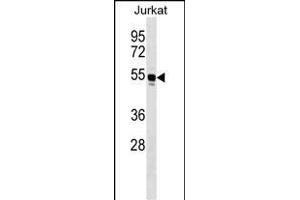 WARS Antibody (C-term) (ABIN1536896 and ABIN2849624) western blot analysis in Jurkat cell line lysates (35 μg/lane). (WARS 抗体  (C-Term))