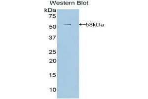 Detection of Recombinant LAMb3, Human using Polyclonal Antibody to Laminin Beta 3 (LAMb3) (Laminin beta 3 抗体  (AA 352-587))