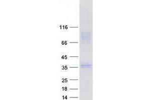 Western Blotting (WB) image for Synaptonemal Complex Central Element Protein 1 (SYCE1) (Transcript Variant 1) protein (Myc-DYKDDDDK Tag) (ABIN2733023)