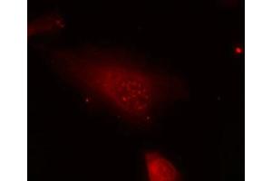 Immunofluorescence staining of methanol-fixed Hela cells using FKHR(Phospho-Ser319) Antibody. (FOXO1 抗体  (pSer319))