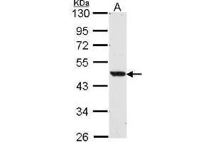 WB Image Sample (30 ug of whole cell lysate) A: A549 10% SDS PAGE antibody diluted at 1:1000 (NR1H2 抗体  (N-Term))