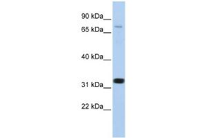 WB Suggested Anti-CACNB2 Antibody Titration:  0. (CACNB2 抗体  (N-Term))