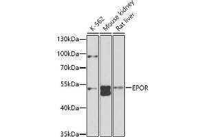 Western blot analysis of extracts of various cell lines, using EPOR antibody (ABIN3016975, ABIN3016976, ABIN1679740, ABIN1679741 and ABIN6219913) at 1:1000 dilution. (EPOR 抗体  (AA 274-508))
