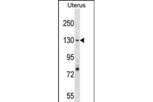RFC1 Antibody (N-term) (ABIN1539238 and ABIN2838143) western blot analysis in Uterus tissue lysates (35 μg/lane). (RFC1 抗体  (N-Term))