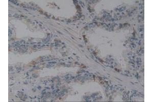 IHC-P analysis of Human Prostate Gland Tissue, with DAB staining. (Angiotensin I Converting Enzyme 1 抗体  (AA 1160-1306))