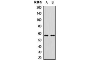Western blot analysis of Cytochrome P450 11B2 expression in HEK293T (A), Raw264. (Cytochrome P450 11B2 (Center) 抗体)