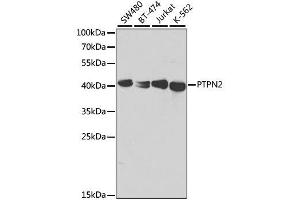 Western Blotting (WB) image for anti-Protein tyrosine Phosphatase, Non-Receptor Type 2 (PTPN2) (AA 1-353) antibody (ABIN3022585)