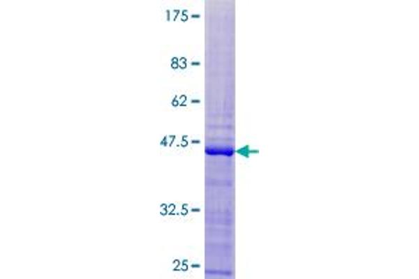 RPL28 Protein (AA 1-137) (GST tag)