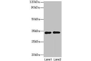 Western blot All lanes: Rgn antibody at 8 μg/mL Lane 1: A549 whole cell lysate Lane 2: HCT116 whole cell lysate Secondary Goat polyclonal to rabbit IgG at 1/10000 dilution Predicted band size: 34 kDa Observed band size: 34 kDa (Regucalcin 抗体  (AA 1-299))