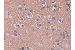 IHC-P analysis of Human Brain Tissue, with DAB staining. (KIF5A 抗体  (AA 473-605))