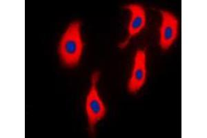 Immunofluorescent analysis of ACTN2 staining in H9C2 cells. (ACTN2 抗体  (N-Term))