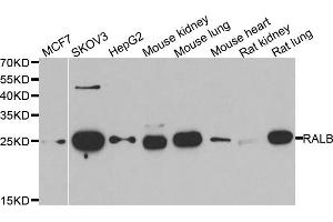Western blot analysis of extracts of various cell lines, using RALB antibody. (RALB 抗体)