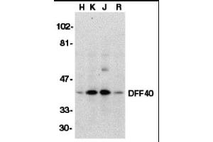 Western Blotting (WB) image for anti-DNA Fragmentation Factor, 40kDa, beta Polypeptide (Caspase-Activated DNase) (DFFB) (Middle Region) antibody (ABIN1030918) (DFFB 抗体  (Middle Region))