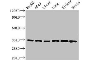 Western Blot Positive WB detected in: HepG2 whole cell lysate, A549 whole cell lysate, Mouse liver tissue, Mouse lung tissue, Mouse kidney tissue, Mouse brain tissue All lanes: GFRA2 antibody at 3. (GFRA2 抗体  (AA 242-415))