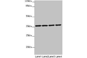 Western blot All lanes: OSGEP antibody at 3. (OSGEP 抗体  (AA 1-335))