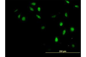 Immunofluorescence (IF) image for anti-General Transcription Factor IIH, Polypeptide 4, 52kDa (GTF2H4) (AA 1-462) antibody (ABIN516273)