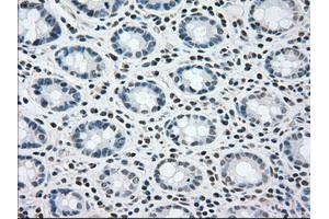 Immunohistochemical staining of paraffin-embedded colon tissue using anti-BRAFmouse monoclonal antibody. (BRAF 抗体)