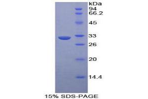 SDS-PAGE analysis of Human EPHA1 Protein. (EPHA1 蛋白)