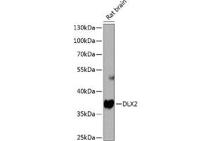 Western blot analysis of extracts of rat brain, using DLX2 antibody  at 1:1000 dilution. (DLX2 抗体  (AA 1-140))
