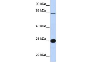 WB Suggested Anti-RALGPS1 Antibody Titration:  0. (RALGPS1 抗体  (Middle Region))