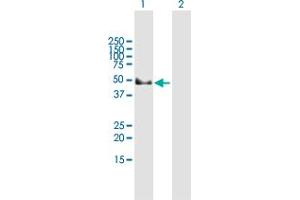 Western Blot analysis of GAK expression in transfected 293T cell line by GAK MaxPab polyclonal antibody. (GAK 抗体  (AA 1-416))