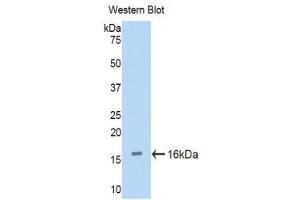 Western Blotting (WB) image for anti-Cubilin (Intrinsic Factor-Cobalamin Receptor) (CUBN) (AA 3511-3623) antibody (ABIN1858562)