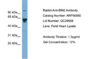 WB Suggested Anti-BIN2  Antibody Titration: 0. (BIN2 抗体  (Middle Region))