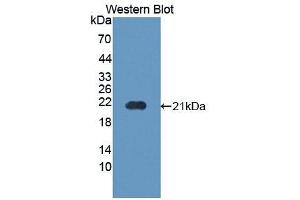 Western blot analysis of the recombinant protein. (PPIB 抗体  (AA 34-216))