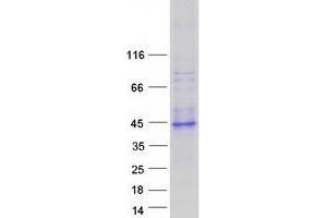 Validation with Western Blot