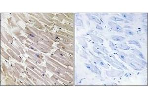Immunohistochemistry analysis of paraffin-embedded human heart tissue, using MRPL16 Antibody. (MRPL16 抗体  (AA 171-220))