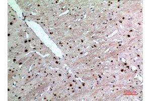 Immunohistochemistry (IHC) analysis of paraffin-embedded Rat Brain, antibody was diluted at 1:100. (KRT14 抗体  (C-Term))