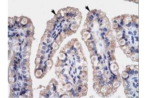 Image no. 1 for anti-High Mobility Group Box 3 (HMGB3) (C-Term) antibody (ABIN203028) (HMGB3 抗体  (C-Term))