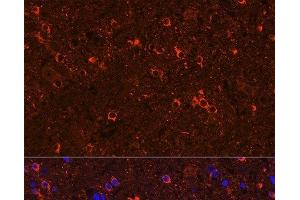 Immunofluorescence analysis of Rat brain using GAD2 Polyclonal Antibody at dilution of 1:100 (40x lens). (GAD65 抗体)