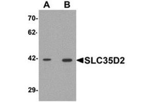 Western blot analysis of SLC35D2 in HeLa cell lysate with SLC35D2 Antibody  at (A) 1 and (B) 2 μg/ml. (Solute Carrier Family 35 (UDP-GlcNAc/UDP-Glucose Transporter), Member D2 (SLC35D2) (C-Term) 抗体)