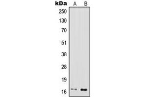 Western blot analysis of IFN gamma expression in MOLT4 (A), Jurkat (B) whole cell lysates. (Interferon gamma 抗体  (Center))