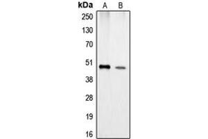 Western blot analysis of Carboxypeptidase A1 expression in Jurkat (A), HeLa (B) whole cell lysates. (CPA1 抗体  (Center))