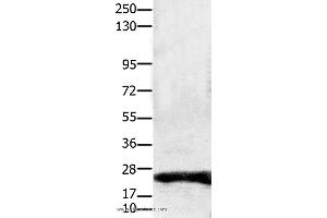 Western blot analysis of Hela cell, using CLDN1 Polyclonal Antibody at dilution of 1:1900 (Claudin 1 抗体)