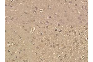 SND1 Mouse Monoclonal Antibody at 1/100 staining rat brain tissue by IHC-P. (SND1 抗体)