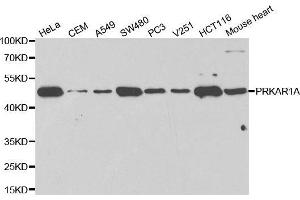 Western blot analysis of extracts of various cell lines using PRKAR1A antibody. (PRKAR1A 抗体  (AA 1-250))